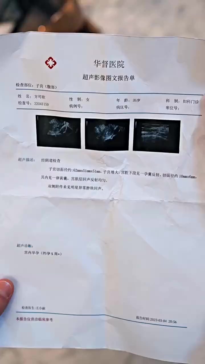 Episode 82